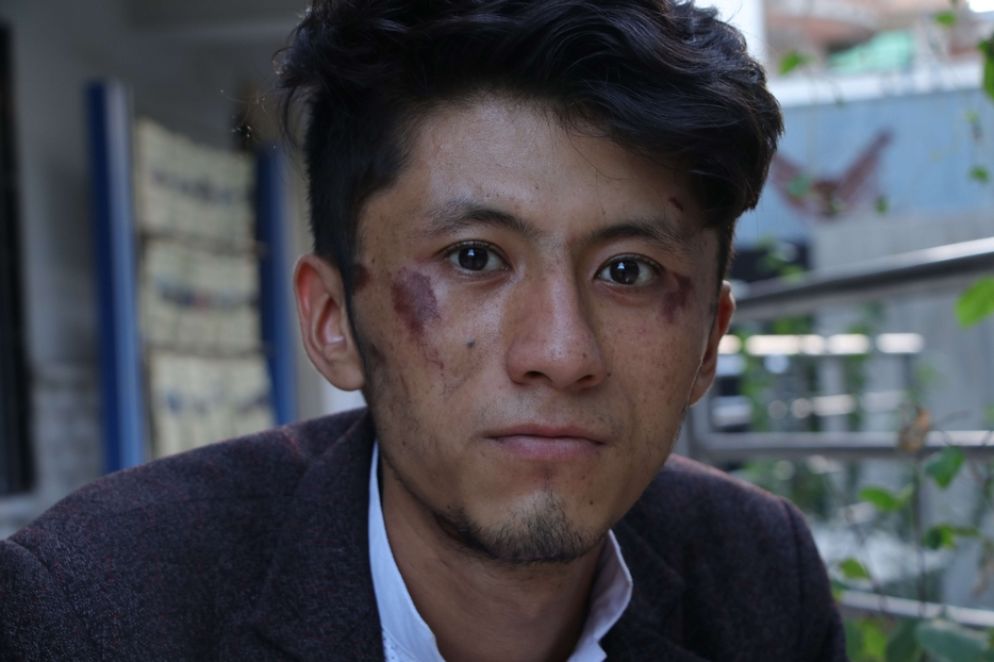 Il fratello del direttore Daryabi è uno dei giornalisti torturati dai taleban a settembre - Archivio