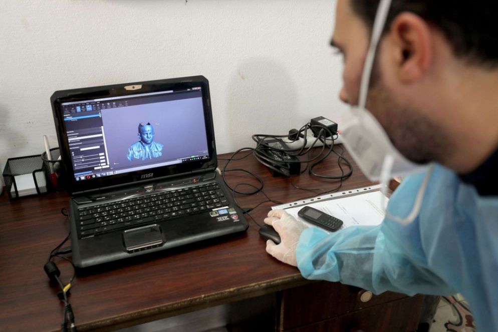 Uno scanner della clinica di Medici Senza Frontiere elabora la maschera terapeutica - Reuters