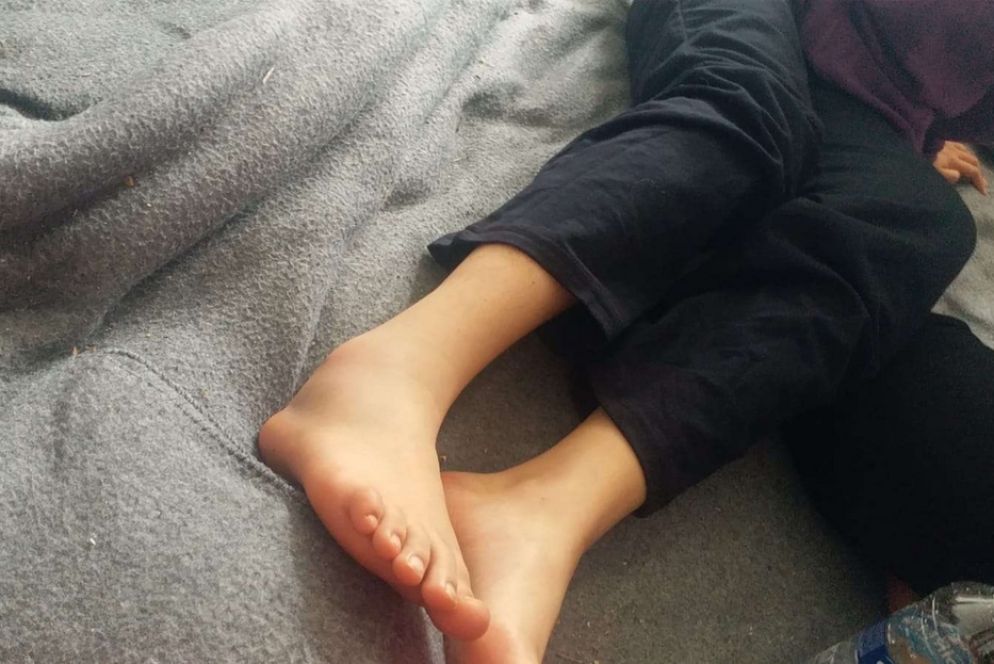 Il piede rotto di una bambina - Foto pubblicata su Twitter da Aegean Boat Report