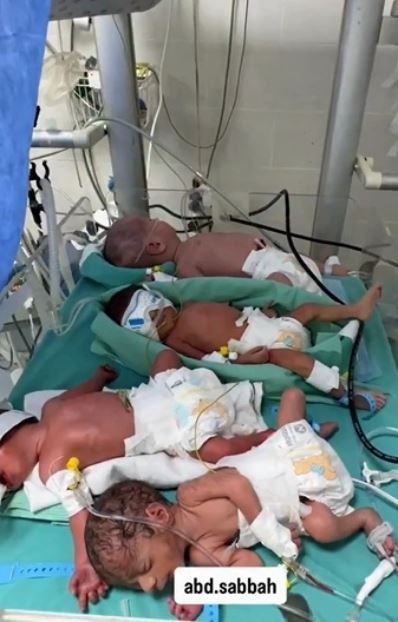 Lo scatto postato su X dal dottor Fadel Naim - .