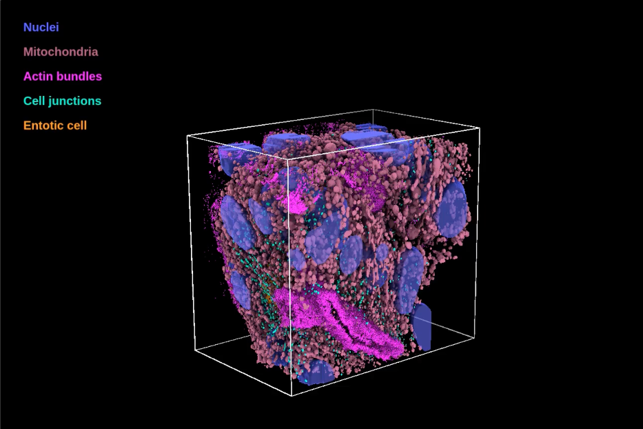 L'osservazione di un organoide del cancro - D'imprima