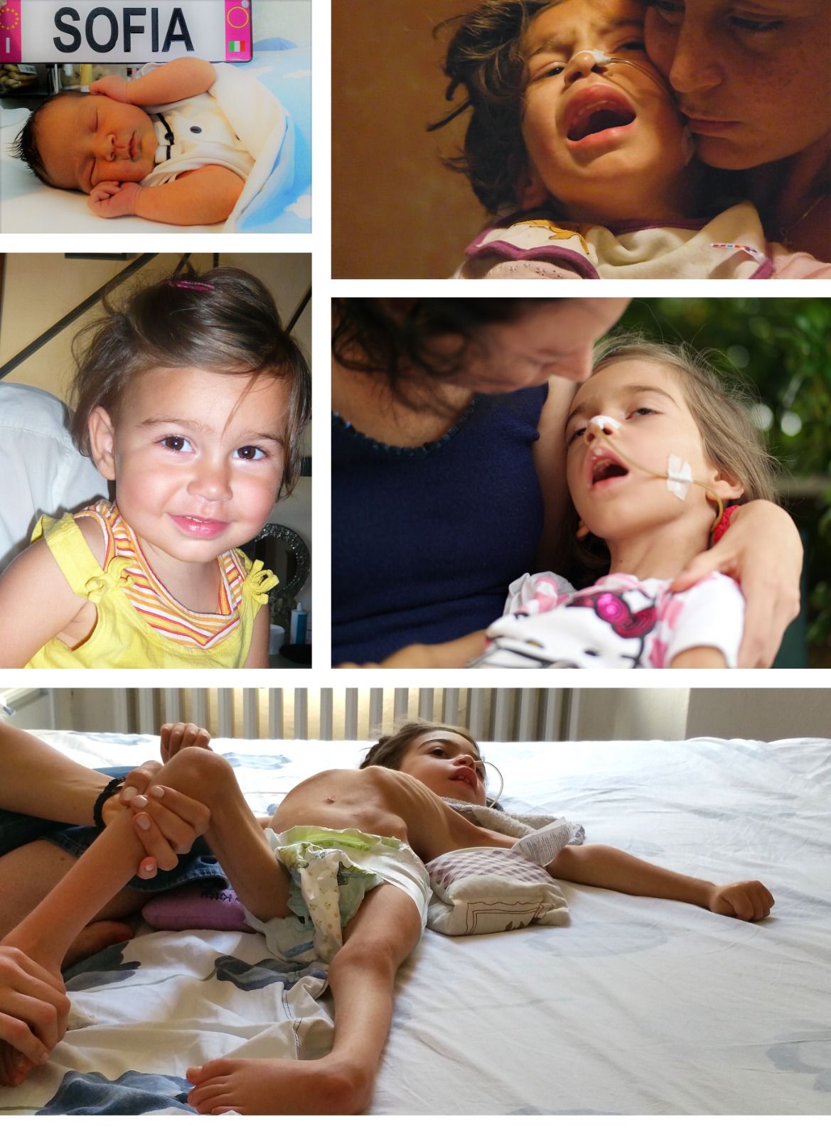 Un collage di Sofia e di cosa significa passare da uno stato di salute ed uno terminale in pochi anni, per colpa della MLD