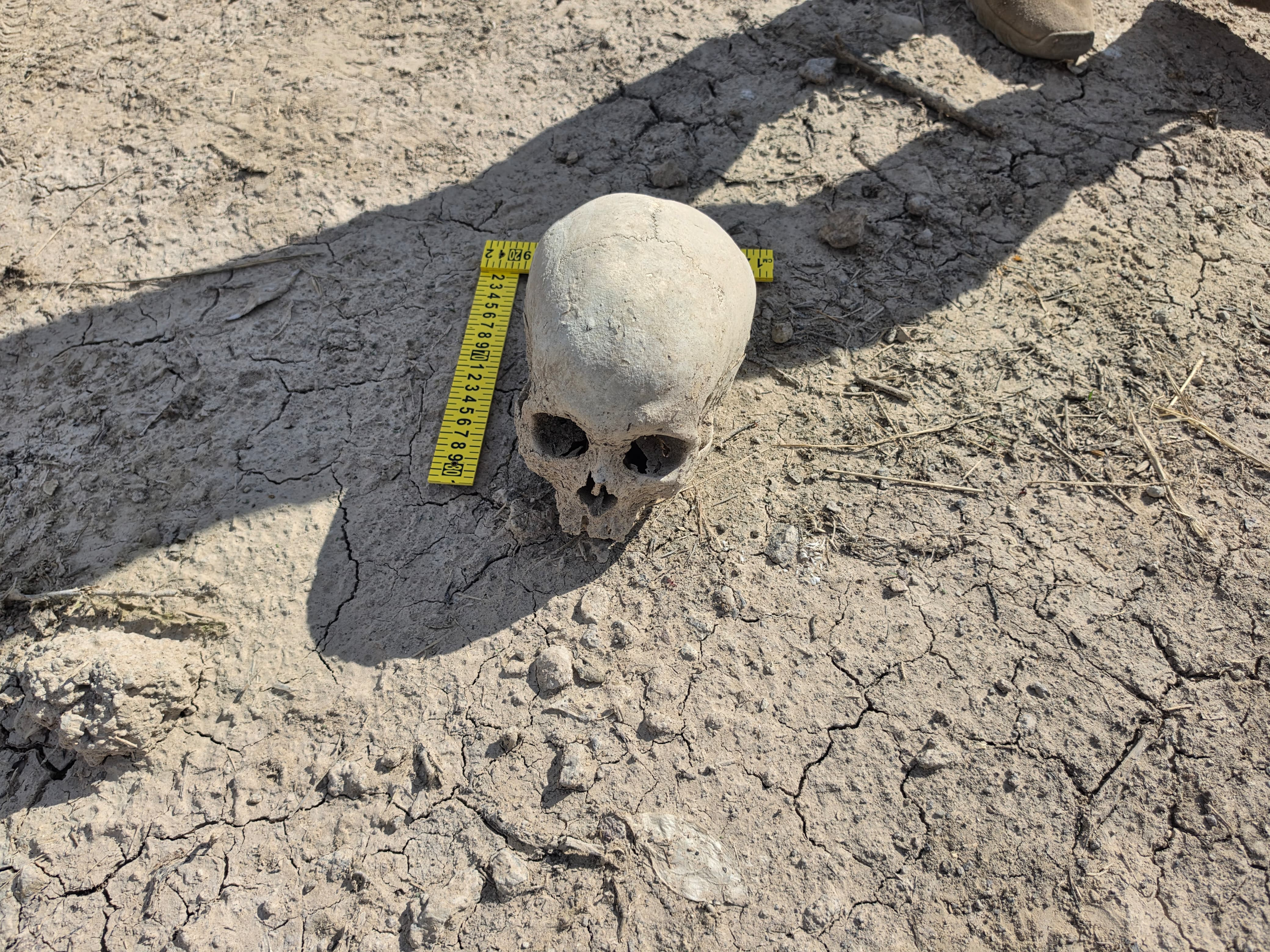 Uno scheletro trovato nella prigione clandestina di Lagos de Moreno, nell'altopiano del Jalisco